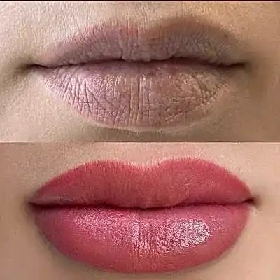 BEFORE AND AFTER PERMANNET LİPS